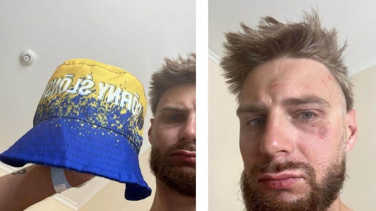 Polish man beaten in Czechia after Silesian colors mistaken for Ukrainian flag